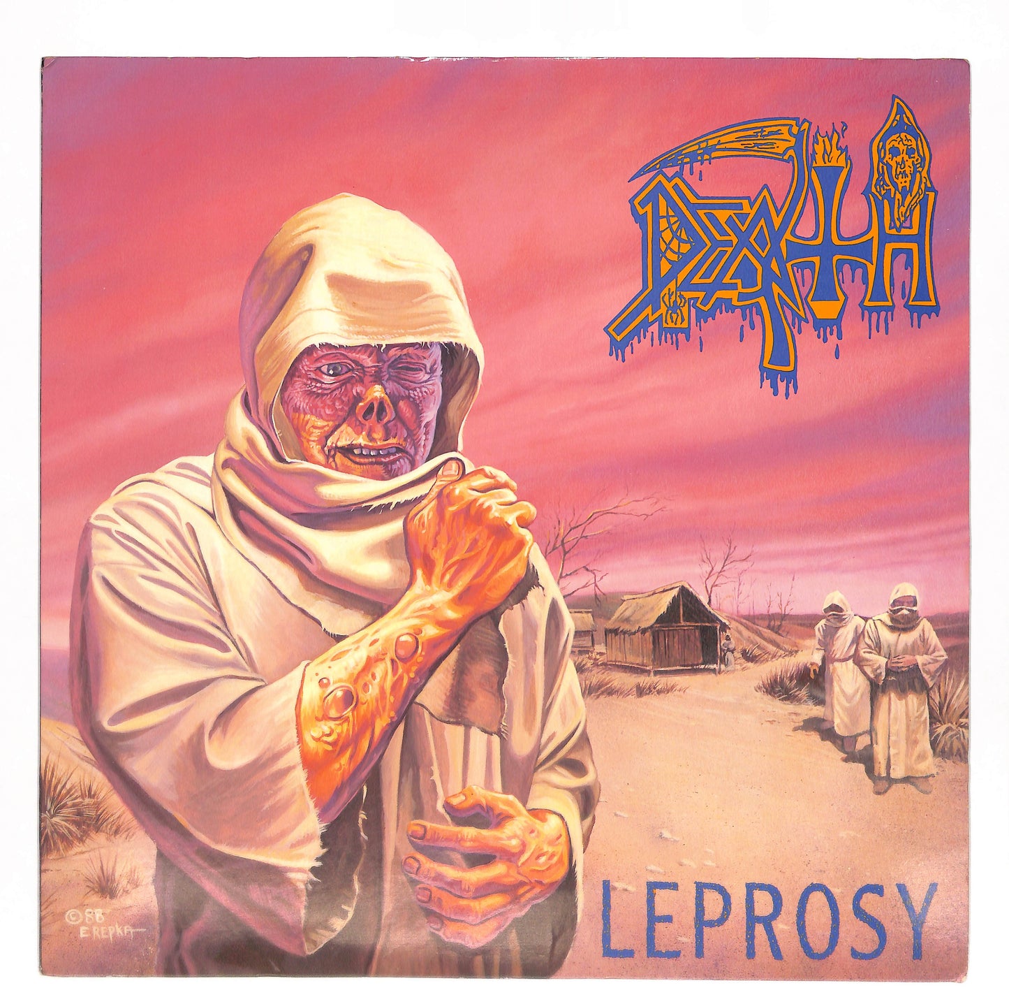 Leprosy